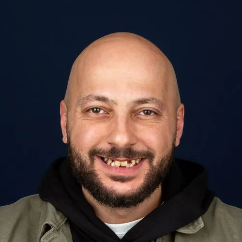 قبل — زراعة الفم الكامل