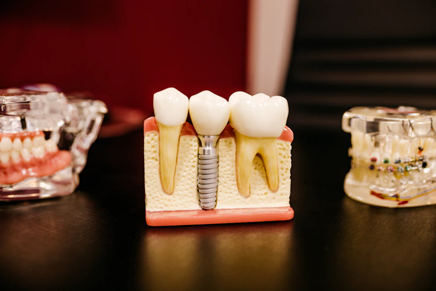 Implanturi dentare