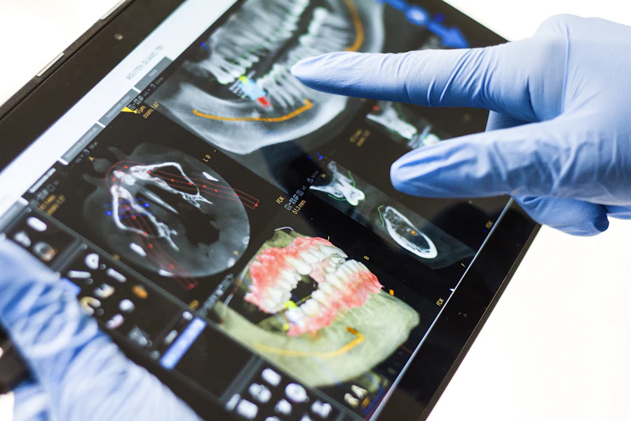 Zâmbetul unui pacient conceput digital ca scanare 3D pe o tabletă